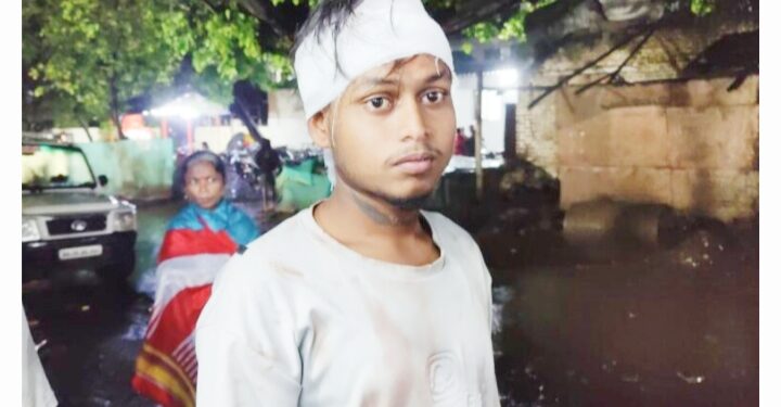 गांधीनगरात विनयभंग केला म्हणून डोक्यात घातला दगड