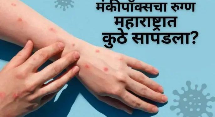 राज्यासमोर मोठं संकट! जगभरात थैमान घालणाऱ्या आजाराचा पहिला रुग्ण सापडल्याने खळबळ